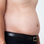 内臓脂肪と皮下脂肪の違いとは？気になる体脂肪を落とすポイント